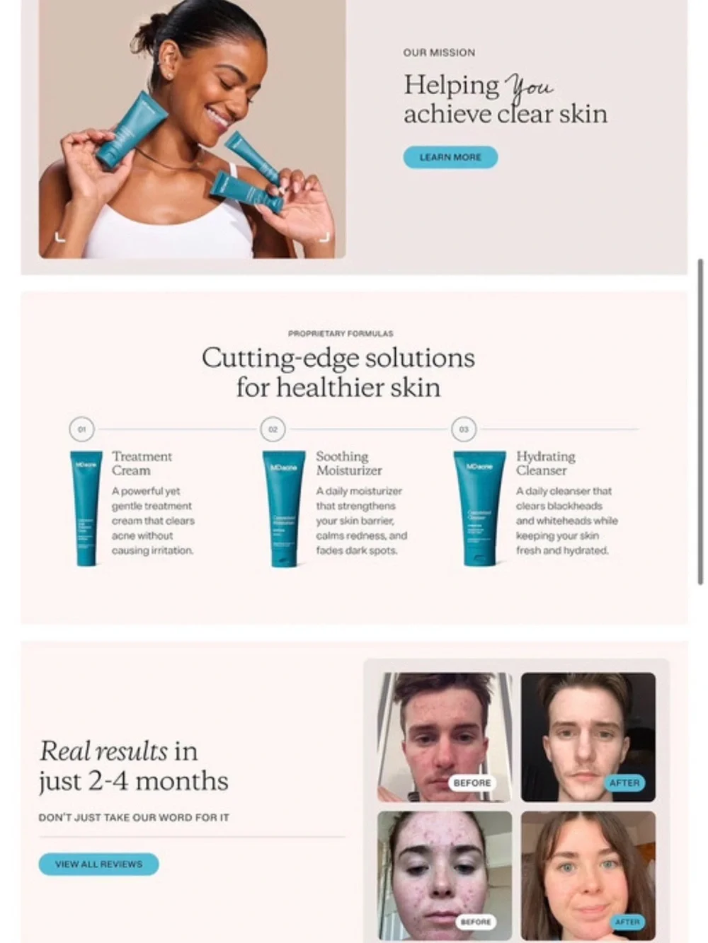 MD Acne 3 Step Acne Treatment Kit 30 Days Great Deal Skin Care